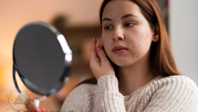 برای جوش زیر پوستی چی خوبه؟ ترفندهای طبیعی و خانگی