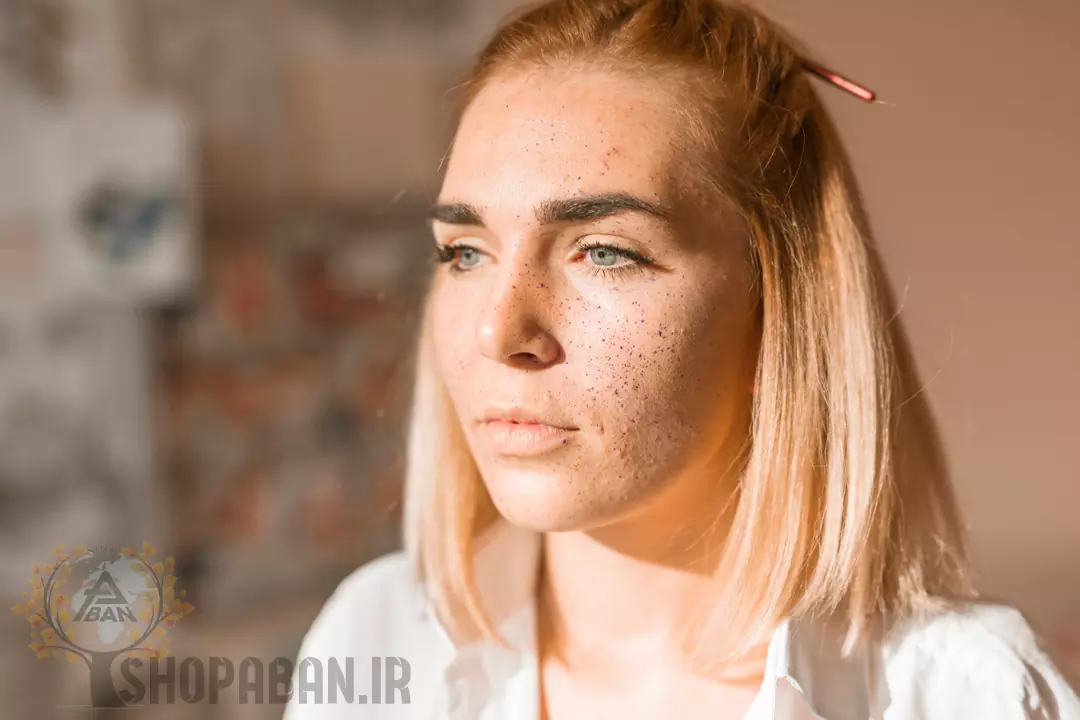 دلایل ایجاد جوش سرسیاه چیست + درمان و رفع جای جوش سرسیاه 100% تضمینی