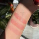 تست بالم لب حرارتی یانگمی روی دست